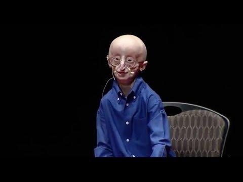 Video 2 - Graham DeLaet