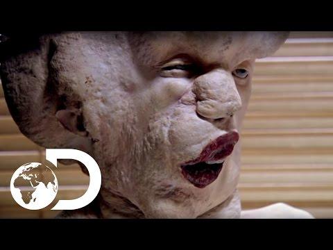 Video 6 - John Merrick