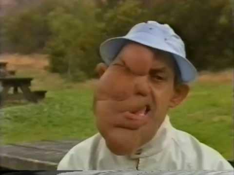 Video 4 - John Merrick