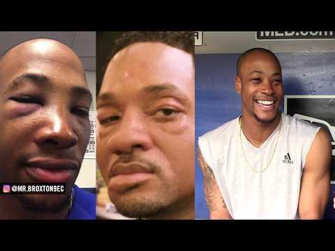 Video 2 - Keon Broxton